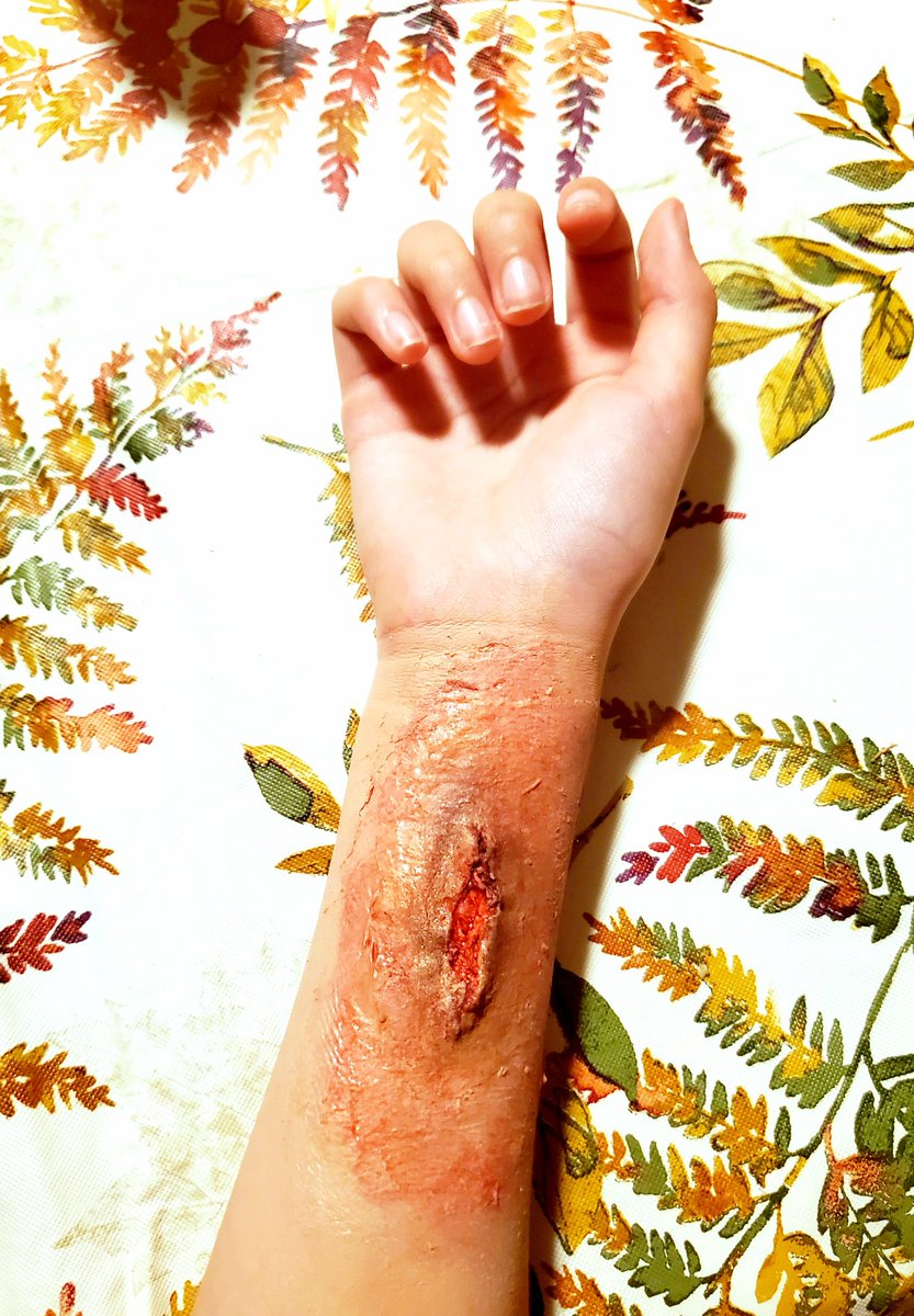 AlyssaRuffin's tweet photo. Deep arm wound! ๐ค๐งก๐งโโ๏ธ๐งน๐ป๐๐งโโ๏ธ #alyssaruffin #specialfxmakeup #makeup #mua #Halloween #Halloween2020 #spookyseason #spookyvibes #fakewounds https://t.co/jZJykcKSfM