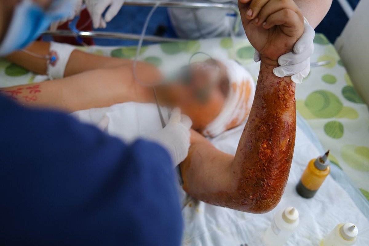 naghdalyan's tweet photo. #Azerbaijan failed to abide by obligation to distinguish btw mil targets &amp; civilians, nor do they take feasible precautions to minimize harm to civilians. In many cases, attacking civilians was targeted &amp; intentional, since mil targets were located very far from civilian objects https://t.co/D6F53qweDo
