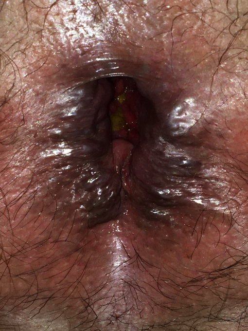 Babe fists 👊 me for the 1st time tonight and got it all in I loved it ❤️❤️❤️ so much was a lil intense