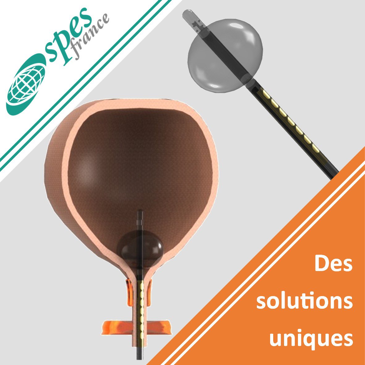SpesFrance's tweet photo. Électrode Cathéter Urétrale à Usage Unique
#spes #spesmedica #spesfrance #ionm #iom #neurophysiologie #usageunique #neuro  #dessolutionsuniques #madeineurope #madeinitaly https://t.co/CDFYOR3Rt1