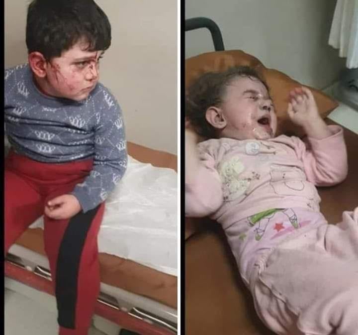Armenian forces attack the Azerbaijan civilians. Because of that many children injured Ganja last week. International society must act against Armenian aggression.

Ermenilere kim dur diyecek? Çocuk demeden sivilleri öldüren Ermenistan Savaş Suçu işliyor!
 #ArmeniaKillsCivilians