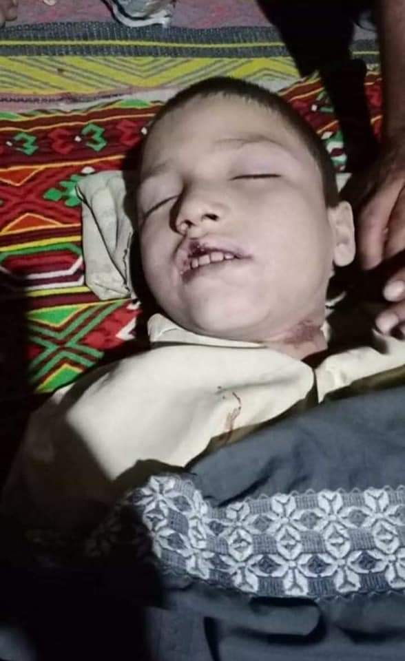 Aimalpsf's tweet photo. قلعہ عبداللہ !کچھ دن پہلے بے گناہ معصوم بچے انعام اللہ کو بے دردی سے شہید کرنے والا قاتل گرفتار ۔
#JusticeForInam https://t.co/J3i7f0Hdyl