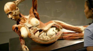 The first exhibition of fully plastified bodies was done in Japan in 1995. I guess it was a success because Von Hagens decided to develop the Body Worlds exhibition, which showcased these bodies in life like poses, some partially dissected to show systems of human anatomy
