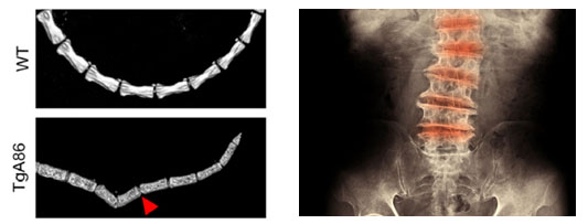 Newly published <a href="/Biomedcode/">Biomedcode</a>
.... a novel transmembrane #TNF driven #mouse model of human #spondyloarthritis.

A  #translational tool for the study of #SpA pathogenesis and the evaluation of human #therapeutics. 

arthritis-research.biomedcentral.com/track/pdf/10.1…