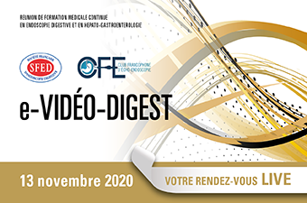 SFED_Endoscopie's tweet photo. e-Vidéo-Digest 2020, c'est dans un mois (vendredi 13 novembre) : les inscriptions sont ouvertes ! Retrouvez aussi les grandes lignes du programme. https://t.co/Ga7StnGQ4U #endoscopie #sfed #eVideoDigest https://t.co/C2VqKVzcgI