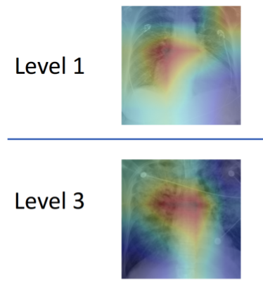 Cn1699's tweet photo. Machine learning tool scans lung X-rays to predict heart failure
#machinelearning #xray #heartfailure #scanningtool
For more information | ⬇️
https://t.co/sN5C0tw81M https://t.co/YN8lpMiVxP