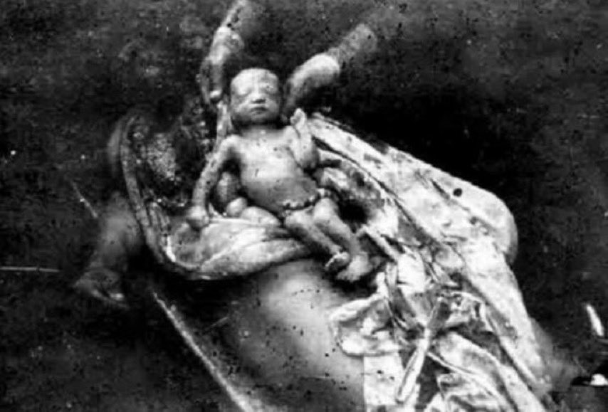 The facts of Armenian violence 
#KharabakhisAzerbaijan 
#DontBelieveArmenian