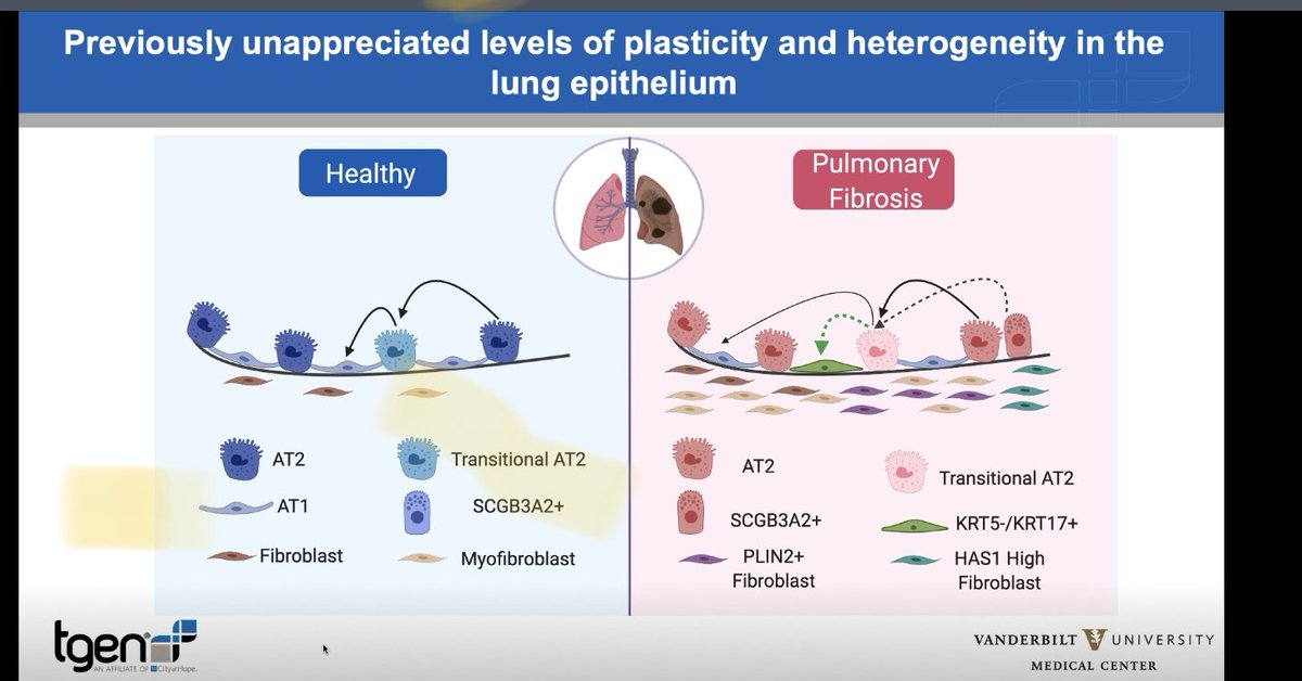 Enjoying a fab @ATS_RCMB webinar on profibrotic epithelial and mesenchymal scRNA seq, focused on @ScienceMagazine pubs from @KaminskiMed @NeBanovich @JKropski #coolscience. Getting all kinds of ideas for my PF ferret model too🤓! 
advances.sciencemag.org/content/6/28/e…
advances.sciencemag.org/content/6/28/e…