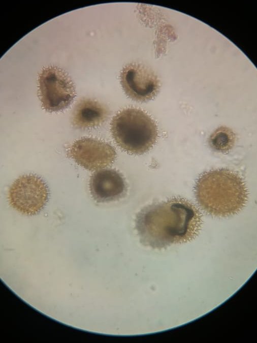 ca_matallana's tweet photo. Happy to collaborate in making a #palynological (#pollen) reference collection. The pollen shapes are incredible, in this case, pollen from two species of #Malvaceae (#Hibiscus sp and #Matisia sp). https://t.co/lbs1dp2iGL