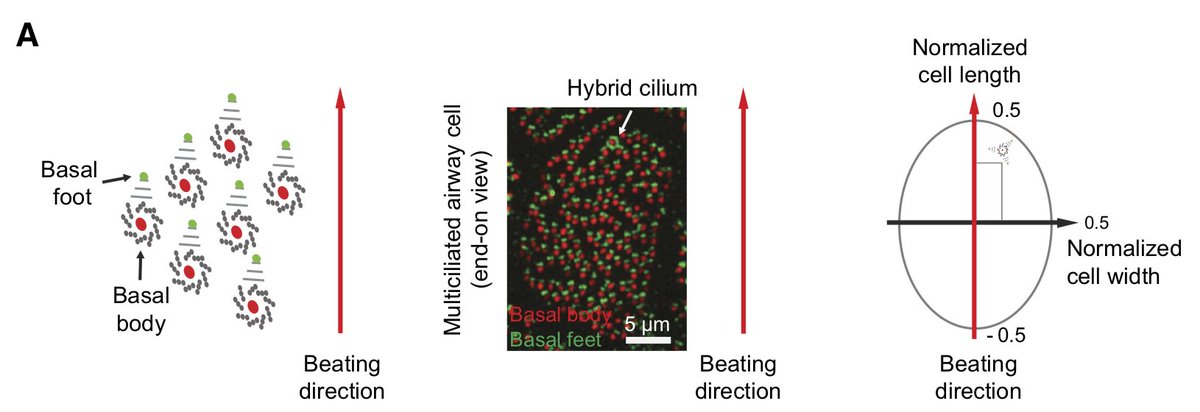 The position of this hybrid cilium is biased towards the leading edge of the cell (ie. direction of ciliary beating). This was confirmed by inducing directional flow over the surface of the cells. Importantly, the biased positioning was lost in PCD patients with immotile cilia.