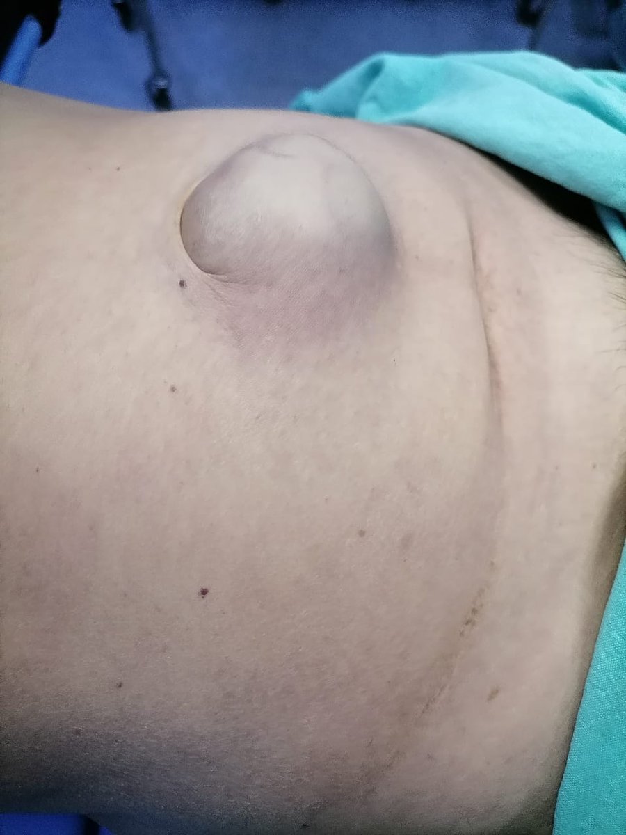 ElCirugia's tweet photo. Pero porque me va a operar Dr. Solo es una hernia!! #herniaestrangulada https://t.co/09NyDi3mn3