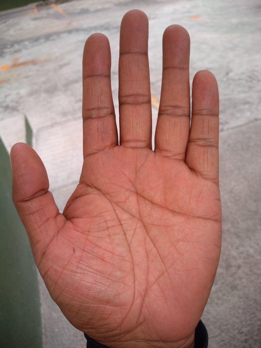 ivanhu14's tweet photo. @mayraying Exceso de líneas y falta de agua. Espero que la línea de la vida sea prolongada en esta o en la otra mano. Saludos https://t.co/IjQZaZzFIX