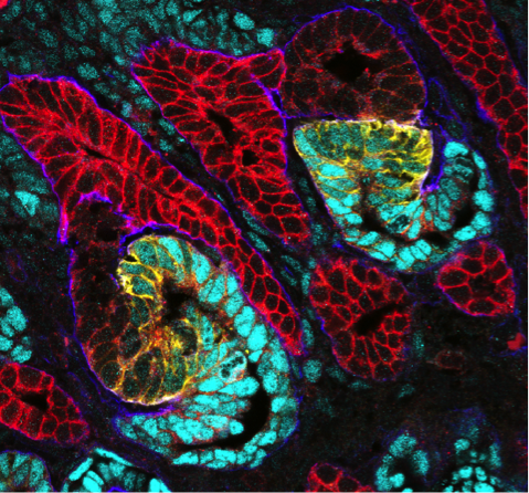 ezeqvarela's tweet image. Maybe we can discuss about #DevelopmentalBiology on #NephMadness 2021!! I think @mettevoe suggested something similar... LET´S ROCK&amp;amp;ROLL! @Nephro_Sparks #KidneyDevelopment @hospitalposadas #EmbrioCat1 @NephMadness gudmap.org/tutorials/kidn…