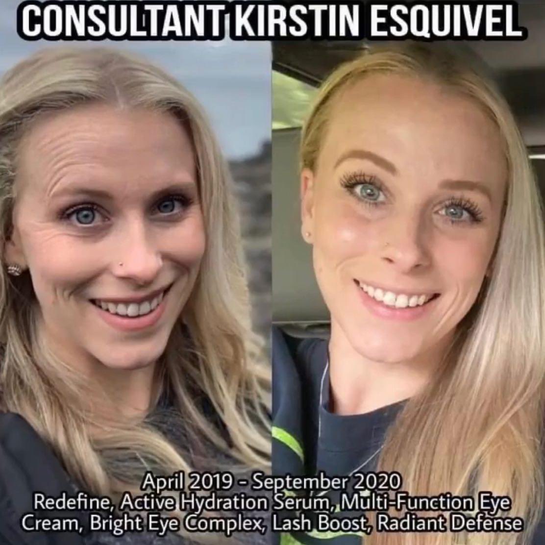 🌟Seriously...This is one of the reasons why I use and sell Rodan & Fields 🌟
look at the transformation Kirstin has gone through with her skin
looks Firmer,brighter, hydrated 💦and healthier 🙌🏻
I am here to help, no pressure 🥰
#feelbetter
#lookbetter
#healthyskin
#firmerskin https://t.co/d4r7RksRKQ