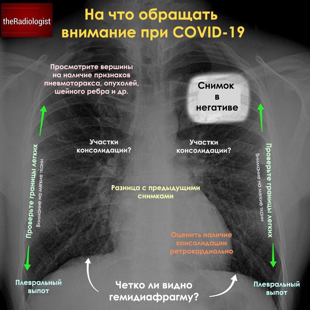 Легкие норма рентген норма