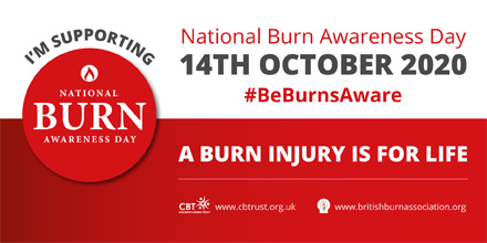 3️⃣0️⃣ babies & toddlers go to hospital with a hot drink burn every day 👶 Keep hot drinks out of reach & #BeBurnsAware ☕ Read about the hidden dangers of hot drinks 👉 safetea.org.uk #NationalBurnAwarenessDay