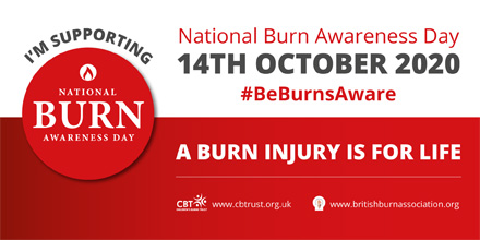3️⃣0️⃣ babies &amp; toddlers go to hospital with a hot drink burn every day 👶

Keep hot drinks out of reach &amp; #BeBurnsAware ☕

Read about the hidden dangers of hot drinks 👉 safetea.org.uk

#NationalBurnAwarenessDay