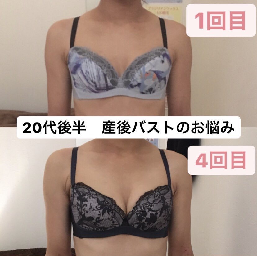 venus ヴィーナス A Twitter 代後半 産後のバスト のボリューム ハリにお悩みのお客様 1カ月に4回のペースでご来店して頂き しっかりボリュームアップ 産後バスト バストアップ バストケア おっぱい先生 ミラクルバスト 横浜 venus ヴィーナス A Twitter 代後半 産後のバスト のボリューム ハリにお悩みのお客様 1カ月に4回のペースでご来店して頂き しっかりボリュームアップ 産後バスト バストアップ バストケア おっぱい先生 ミラクルバスト 横浜