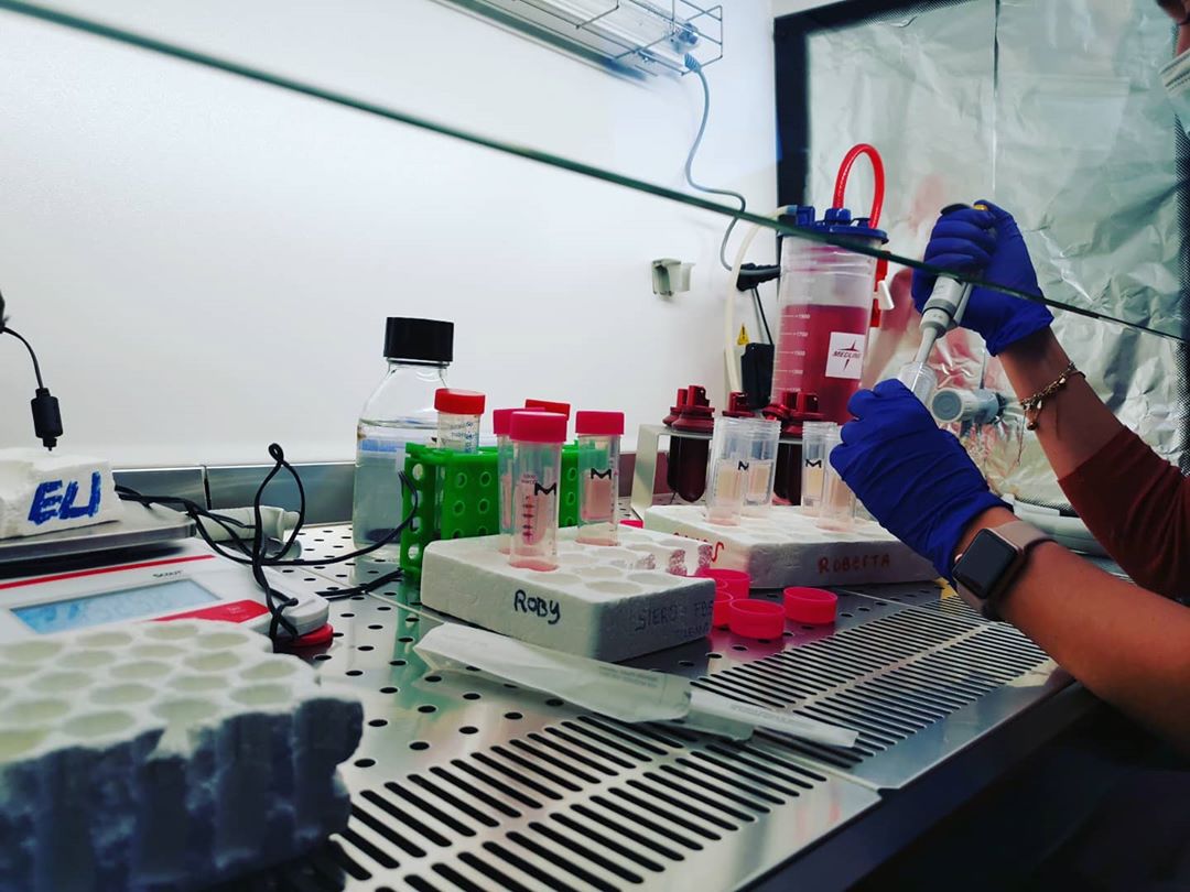 starstem2020's tweet photo. Dealing with media concentration #starstemESR #extracellularvesicles #MSC

📷 https://t.co/wGh1ZzuwPt https://t.co/ngwKRNicjt
