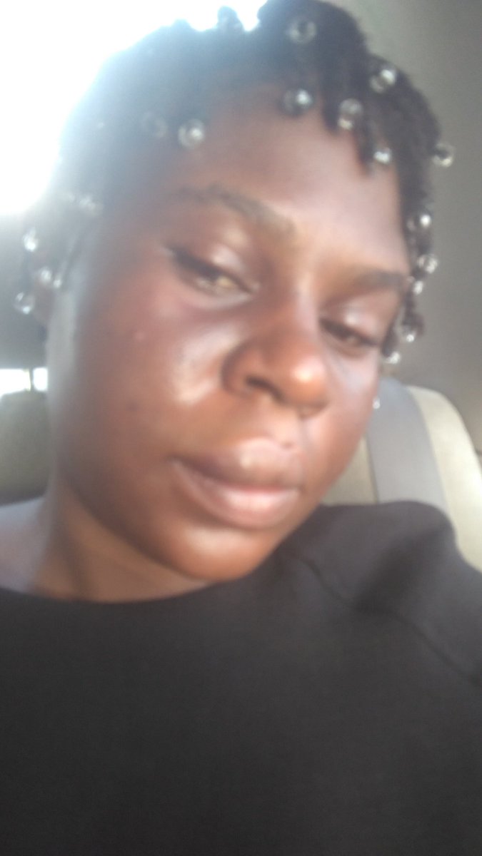 Thickerbody_08's tweet photo. What was my crime again? I was protesting against police brutality and I got brutalised for it . #EndSARS #EndSWAT #EndPoliceBrutalityinNigeria https://t.co/AboZeuzx8m
