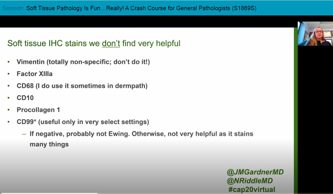 NHardy_path's tweet image. Vimentin may be the most triggering IHC to order 😂 was surprised to see some of the other IHCs on this list, but Dr. Riddle did a great job explaining her reasoning 👍 @NRiddleMD @cap20virtual