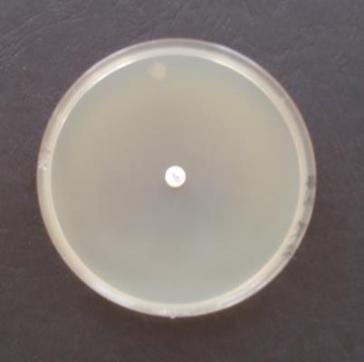 And on the topic of antibiotic resistance, why not show up as a Kirby-Bauer antibiotic sensitivity test. Yeah, the lack of clearing around the antibiotic disc (growth) is indicative of bacterial resistance. Scary!