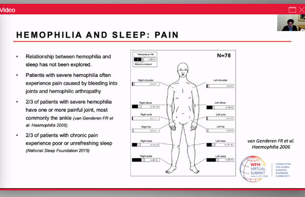 wfhemophilia's tweet photo. Our #WFHVirtualSummit Session “Multi Plenary: Quality of life ” is available to view online! For those who missed it, or those who want to watch again, learn about the role of pain in the life of someone with a #bleedingdisorder. Watch it here: https://t.co/vXcZKjp7Ev https://t.co/4IvCOwAlPQ