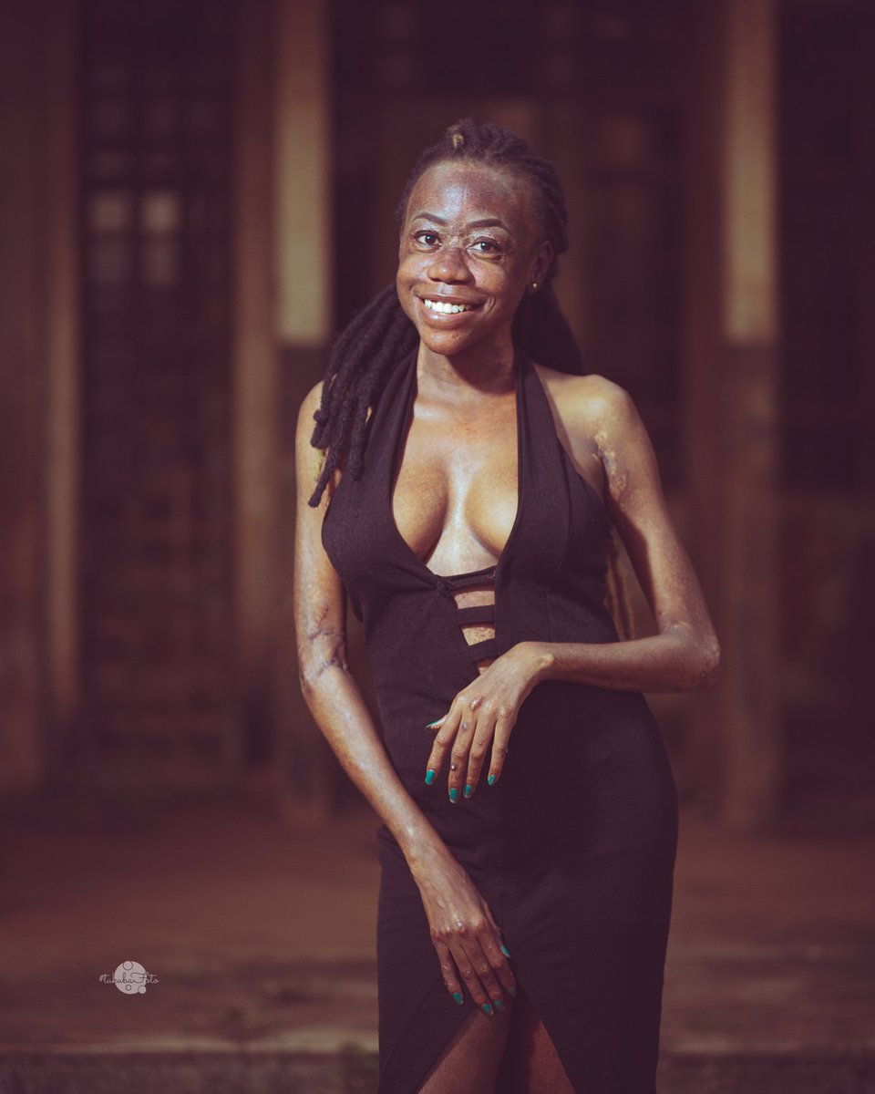 Bossbaeomubwati's tweet photo. Hey ....issa wednesday. And well this shoot is probably one of the last i will do with these scars.
#wcw
#tonairobi https://t.co/ALq8QOPtzV