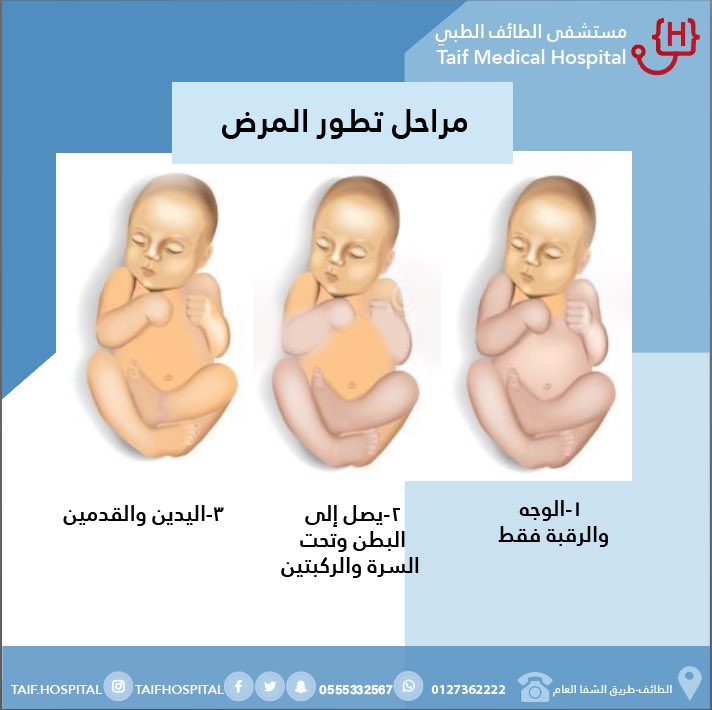 TaifHospital's tweet photo. https://t.co/MaXMVHBNXx