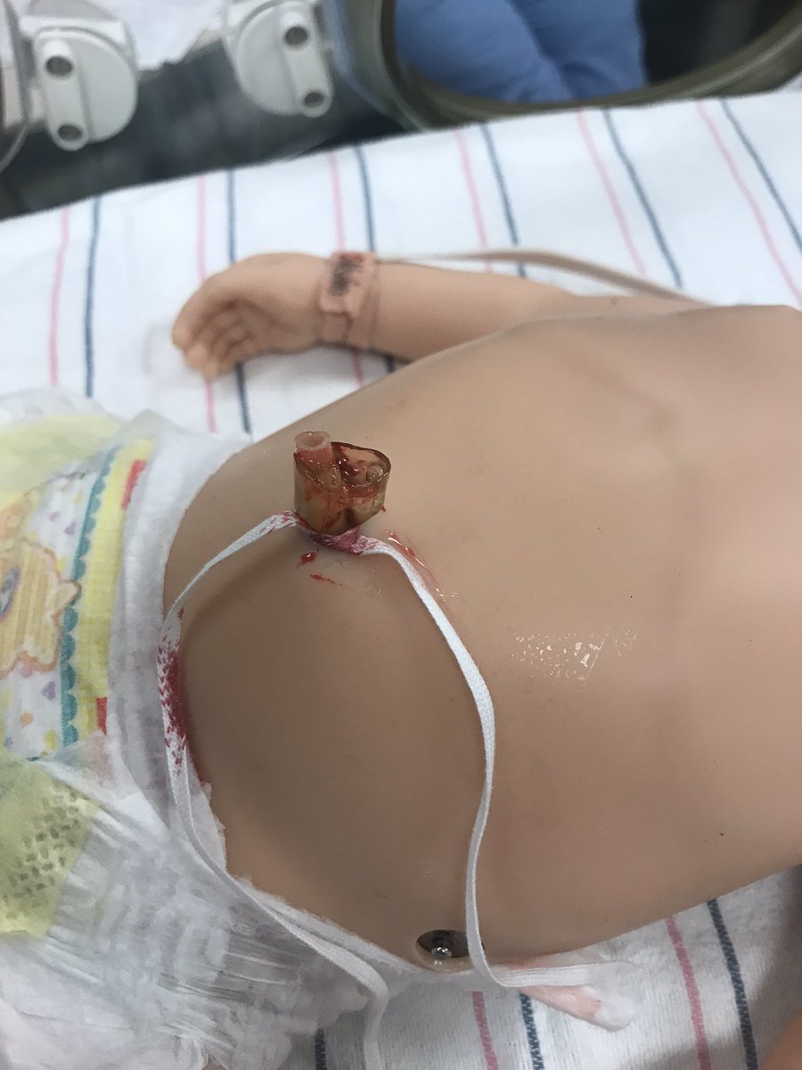 s921v's tweet photo. SBML NNP bootcamp today! #SimSavesLives #BabySim #UmbilicalLineDeliberatePractice My brilliant colleague @DahlenBrittany running the show! https://t.co/2k9NXW9eFx