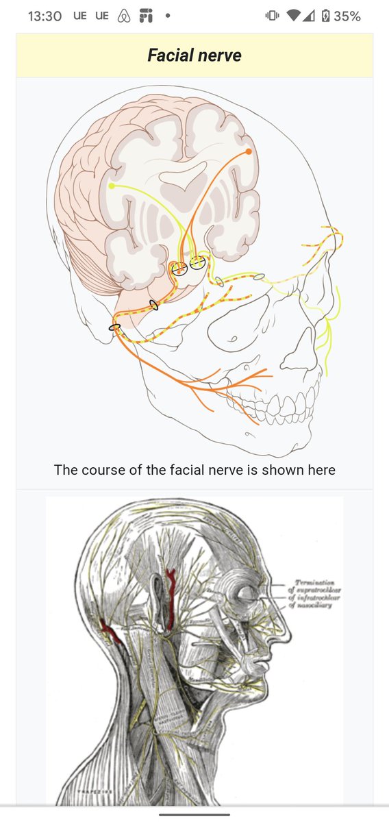 I was prompted by this tweet to dig into which cranial nerve is related to Bells Palsy and its the facial nerve. Ive had issues with this nerve as well because of a operation gone wrong on my Tendomanibular joint  https://twitter.com/podcastnotes/status/1316411093124866048?s=19