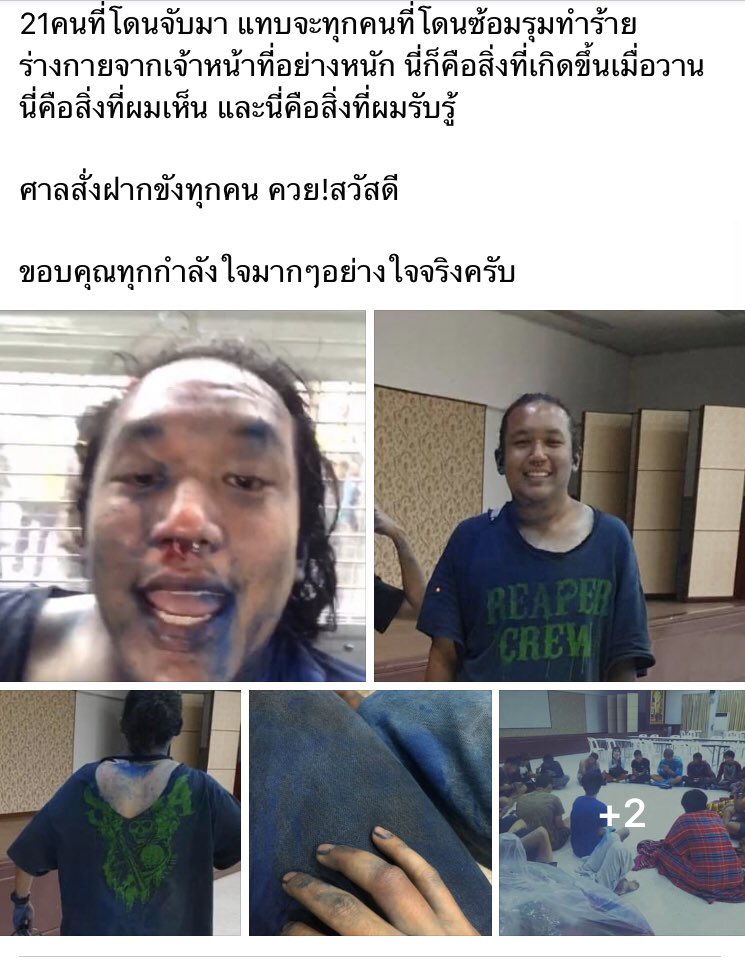 TLHR2014's tweet photo. วชิรวิชญ์ ลิมป์ธนวงศ์ นศ.ม.รังสิต หนึ่งในผู้ถูกคุมขังคดี #คณะราษฎรอีสาน โพสต์ก่อนเข้าเรือนจำ เล่าเรื่องเหตุการณ์ถูกจับกุม ซึ่งจนท.มีการใช้กำลังรุมทำร้าย จนบาดเจ็บหนัก และไม่ได้ถูกรักษาหรือทำแผลใดในระหว่างถูกคุมตัว

#ม๊อบ14ตุลา https://t.co/uBBHlaA7Q8