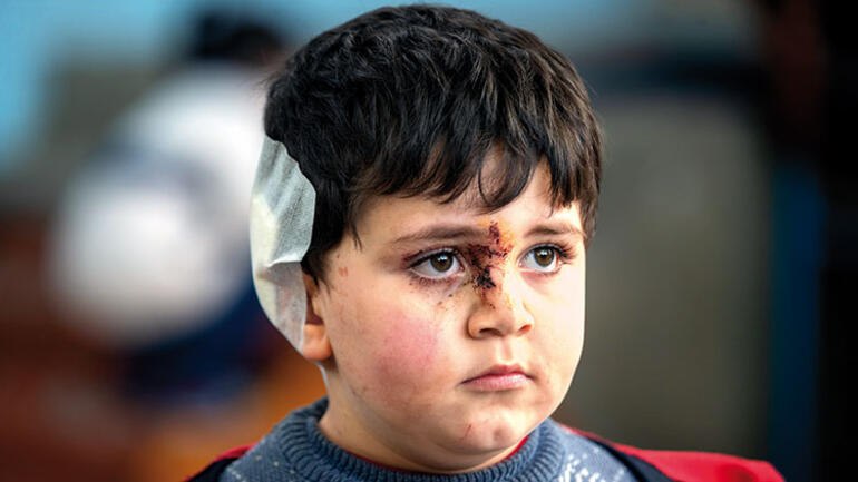 Armenian military forces attack the Azerbaijani civilians.Because of that many children injured  in Ganja last week. The international society must act against armenian aggression.
#OMM2020
#openyoureyes
#Ganja #ArmeniaKillsCivilians #DontBelieveArmenia