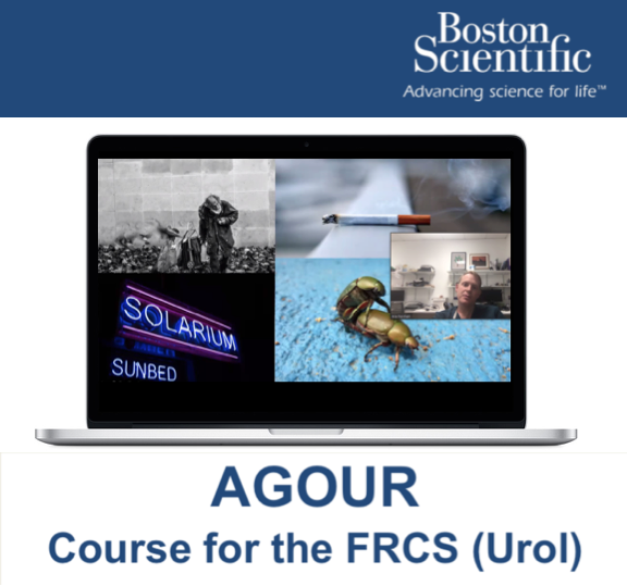 EdHolyoak's tweet photo. Thank you @arieurology for a dynamic and engaging overview of penile cancer for #AGOUR. Join us Saturday with @EardleyIan bringing the series to a close with #ErectileDysfunction. Free to all for a brush up or surgical trainees about to sit FRCS(Urol) https://t.co/jQJ5MLsS6Z https://t.co/VkCYIseZWa