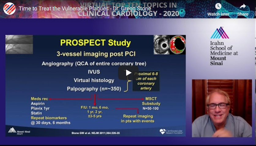 ccclivecases's tweet photo. Watch "Time to Treat the Vulnerable Plaques – Dr. Gregg Stone"
https://t.co/j610Uea1zy
@GreggWStone @MountSinaiHeart
#toptentopics #clinicalcardiology #mountsinai #interventionalcardiology #ccclivecases #vulnerableplaque https://t.co/b205cwtAXT