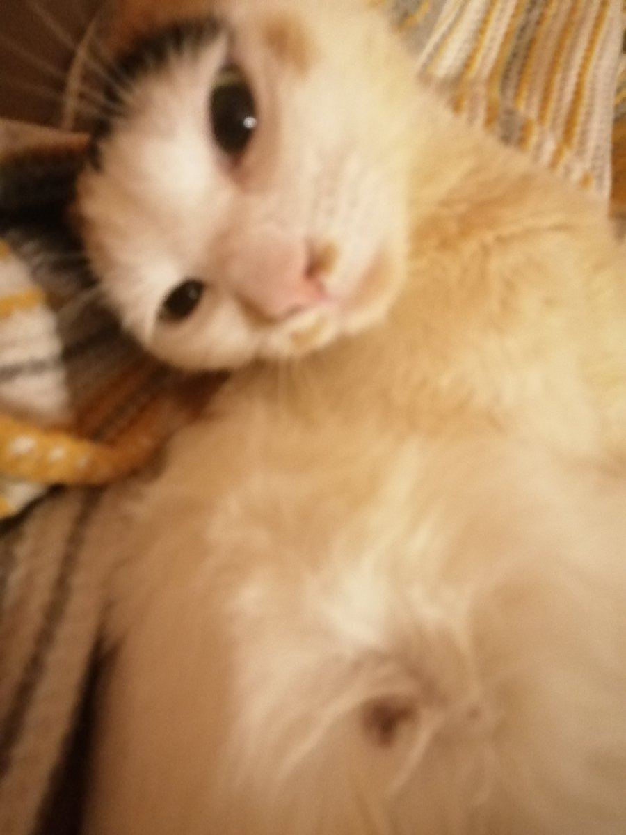 Şarkılar beni söyler,dillerde nağme adım.39 gün kaldı tedavimin bitmesine.2.resimde vücudumda iğne olmaktan gelişen yaralarıma bakıp ne çok çaba verdiğimi düşünün.Çok sessiz kırılganım. Yaşamam için lütfen destek olun. 🧚‍♀️🧚‍♀️🧚‍♀️