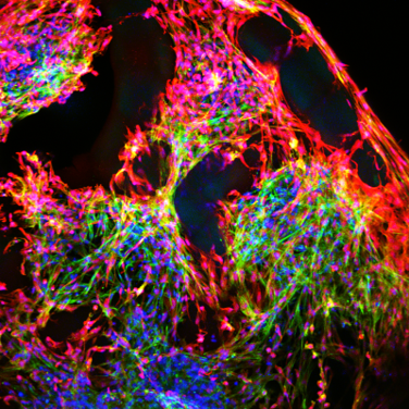 While moving several human antibody candidates forward in IND enabling studies (#sarscov2) we haven't forgotten our #3dtissue #engineering and will be excited to share updates soon. (image: 3D astrocytes cultured on VTBs - vascular bundles - from the Prellis lab).