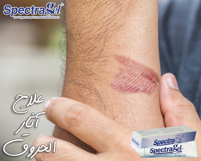 SpectragelEgypt's tweet photo. عند التعرض للحروق لاقدر الله، يجب تبريد مكان الحرق بالماء الفاتر وفي حالة التأكد من أن الحرق بسيط يمكن أن نبدأ بخطوات الوقاية من تكون أثر للحرق بإستخدام سبكتراجل. https://t.co/FvDENFtRsJ