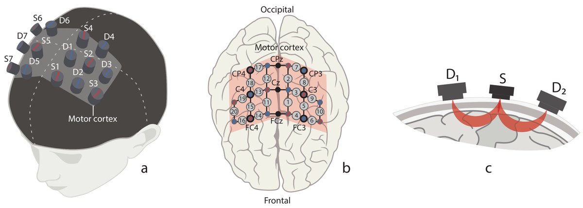 Functional Near-Infrared #Spectroscopy for the Classification of Motor-Related #Brain Activity on the Sensor-Level
<a href="/InnopolisU/">Innopolis University</a> 
👉mdpi.com/1424-8220/20/8…

#Spectroscopy
#Brain
#Sensors