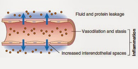 thebiomagnetism's tweet photo. #Exudates
All #pathogenicmicroorganisms produce exudates. These exudates can accumulate and make any part of the body sick. They can be produced by the pathogen itself or by the over-excitation of the cells affected by it.
#BiomagnetismTherapy #Biomagnetism #BiomagneticSessions https://t.co/FWsrn3OkIw