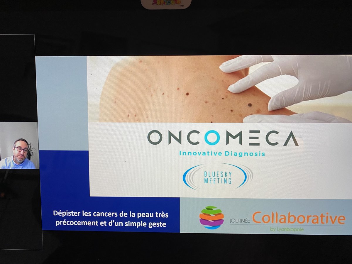 Lyonbiopole's tweet photo. [#SemaineCollaborative] #LBPmember #ONCOMECA développe un #dispositifmedical breveté combinant des capteurs mécaniques et optiques à une #IA pour  démocratiser le #diagnostic précoce des #cancers de la peau. #innovation #Sante https://t.co/caBavDIhpA
