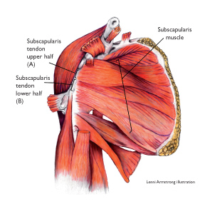 terapiamanualUE's tweet photo. ¿Sabemos, o mejor dicho, recordamos que el músculo #Subescapular tiene 2 vientres (SUP e INF), inervados por separado y con diferentes líneas de acción?
Aquí ⬇️abordan y demuestran sus funciones y en que posiciones predominan cada uno de los 2.
https://t.co/Z2Oa5YNrny https://t.co/0HDTA95X4K
