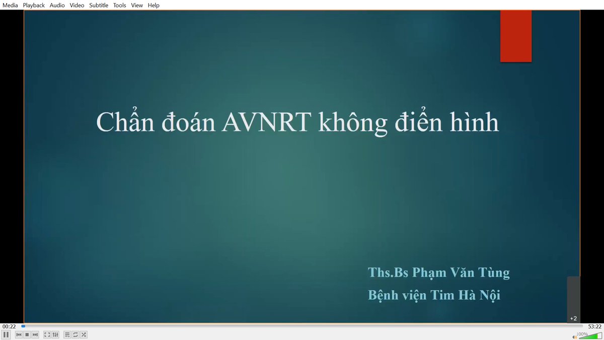 AnhNguyenMrMax1's tweet photo. The 5th #EPFoundation was successfully conducted on Fri 9th Oct - Atypical AVNRT. Thanks to Dr Nhu Hung and Dr Pham Tung from Hanoi Heart for sharing the precious knowledge in #EP
Next Fri will be a topic of VT.
#abbott #abbottproud #abbottep
Thank @hikingsley87 for hosting https://t.co/QoEYmZ4soS