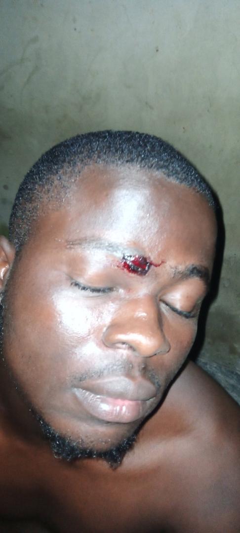 Theoladeledada's tweet image. Why are people not talking about what is happening in Osogbo? Thugs were paid to hijack protest &amp;amp; now they are attacking peaceful protesters in #Osogboprotest.

Soro Soke fun wa @OgbeniDipo, @Ebuka, @YemieFASH, @Joshua_Ubeku, @UnclePamilerin, @mrmacaronii, @Moyo_VIP

#EndSars