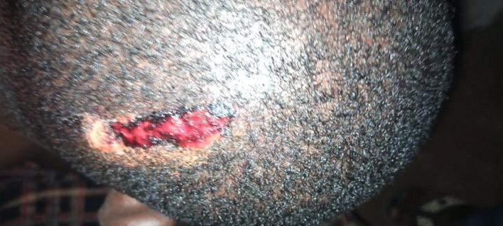 Theoladeledada's tweet image. Why are people not talking about what is happening in Osogbo? Thugs were paid to hijack protest &amp;amp; now they are attacking peaceful protesters in #Osogboprotest.

Soro Soke fun wa @OgbeniDipo, @Ebuka, @YemieFASH, @Joshua_Ubeku, @UnclePamilerin, @mrmacaronii, @Moyo_VIP

#EndSars