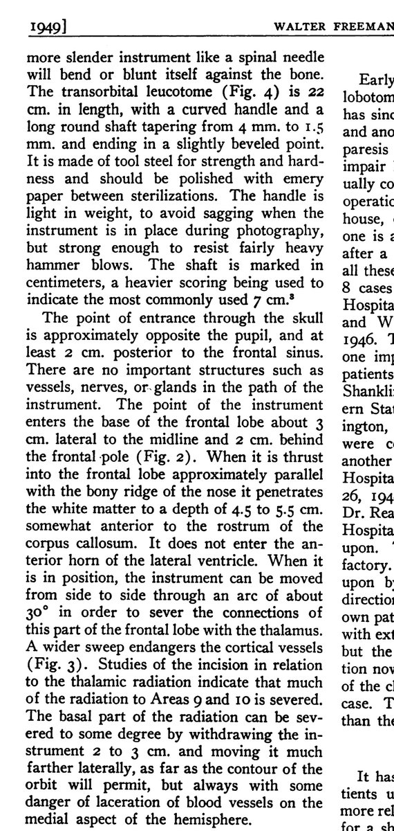 Daniel_Urologia's tweet photo. Interesting to read one of the original papers of Walter Freeman from 1949 describing technique and results of transorbital lobotomy.

Even though it sounds completely barbarian, reading it gives a lot of context.

Lobotomy was already being performed in prefrontal manner.

1/5 https://t.co/V3eVVcsBdV