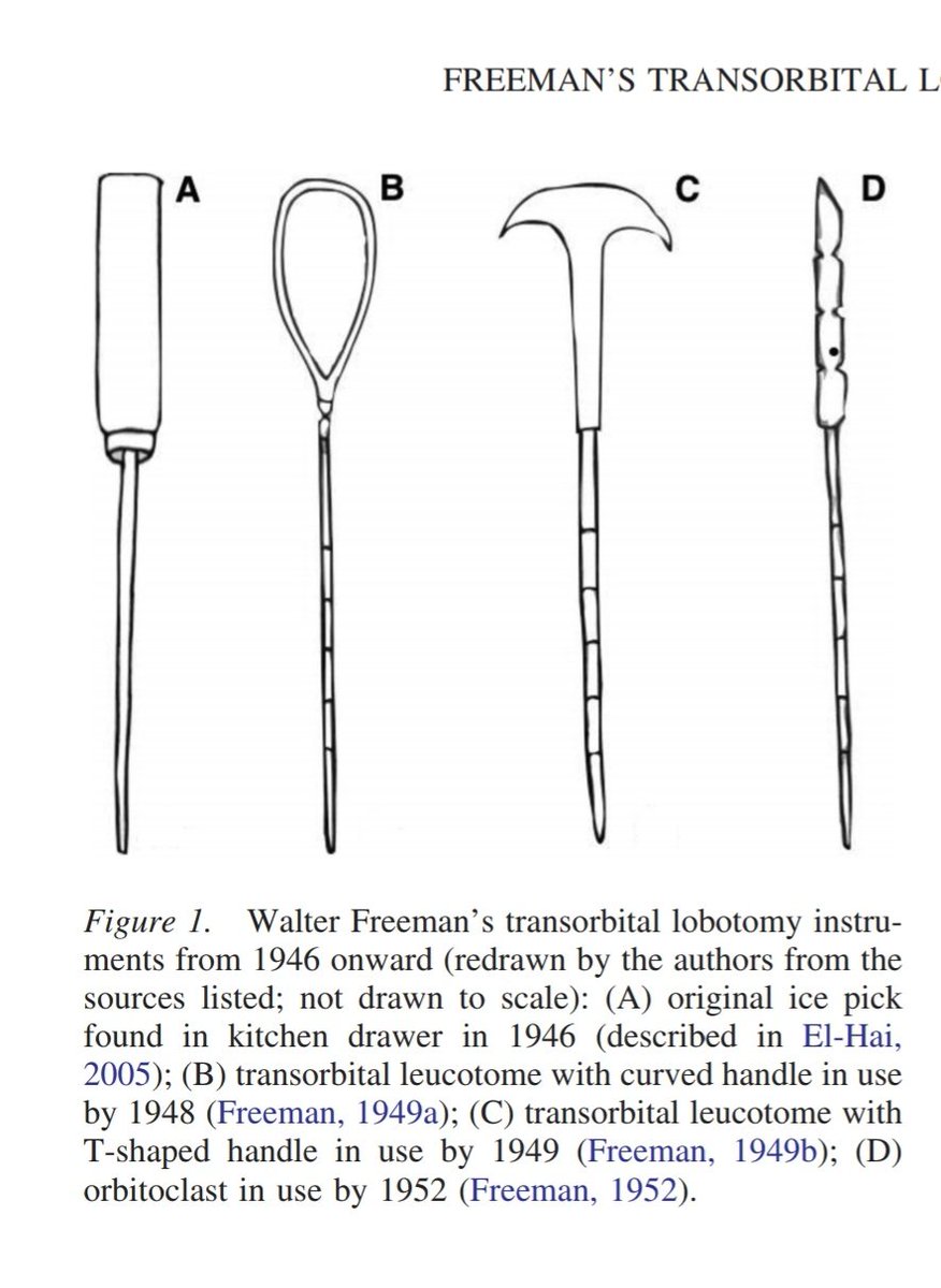 Daniel_Urologia's tweet photo. Prior results were conflicting so Freeman tried to develop an easier technique and the neuro anatomy  knowledge from the paper seems good.

Certainly the first cases were maybe not as encouraging as described and the tools developed were not sofisticated at all...

2/5 https://t.co/saSZs2RHxl