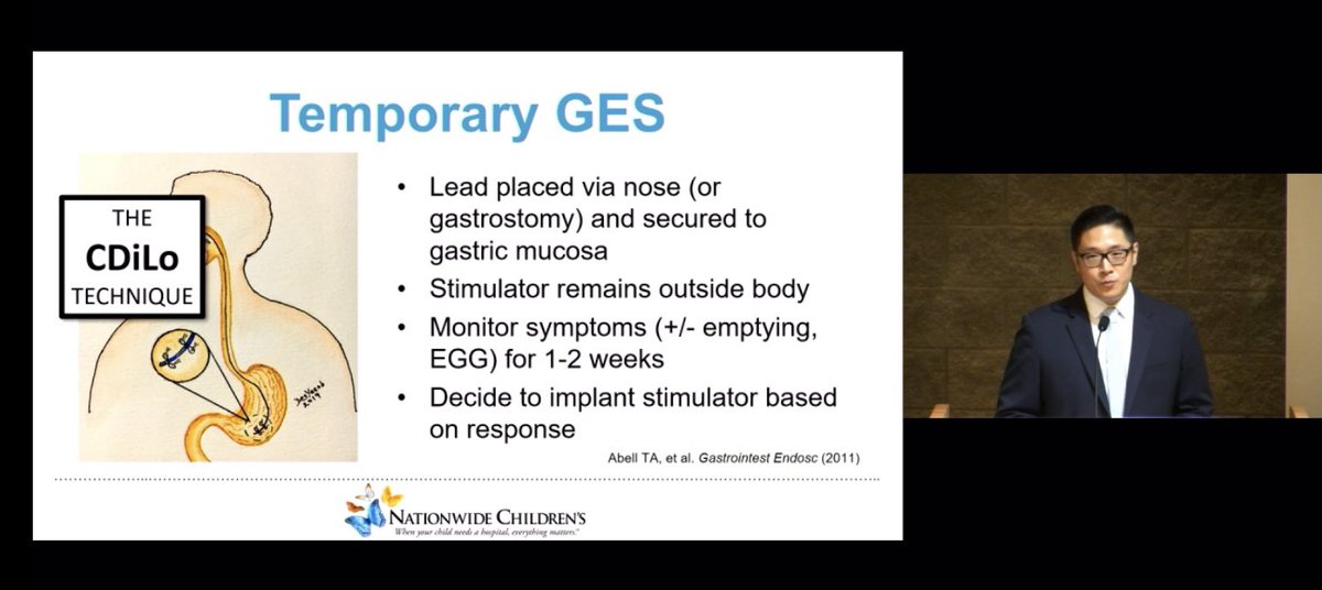 dr_rdvenkatesh's tweet image. ⁦@PLLU⁩ describes the #CDiLo technique in gastric stimulation: an important trial prior to placing a gastric pacemaker. 

⁦@deslilo⁩ ⁦@CarloDiLorenzo1⁩ #pedgitwitter #ges #cdilo