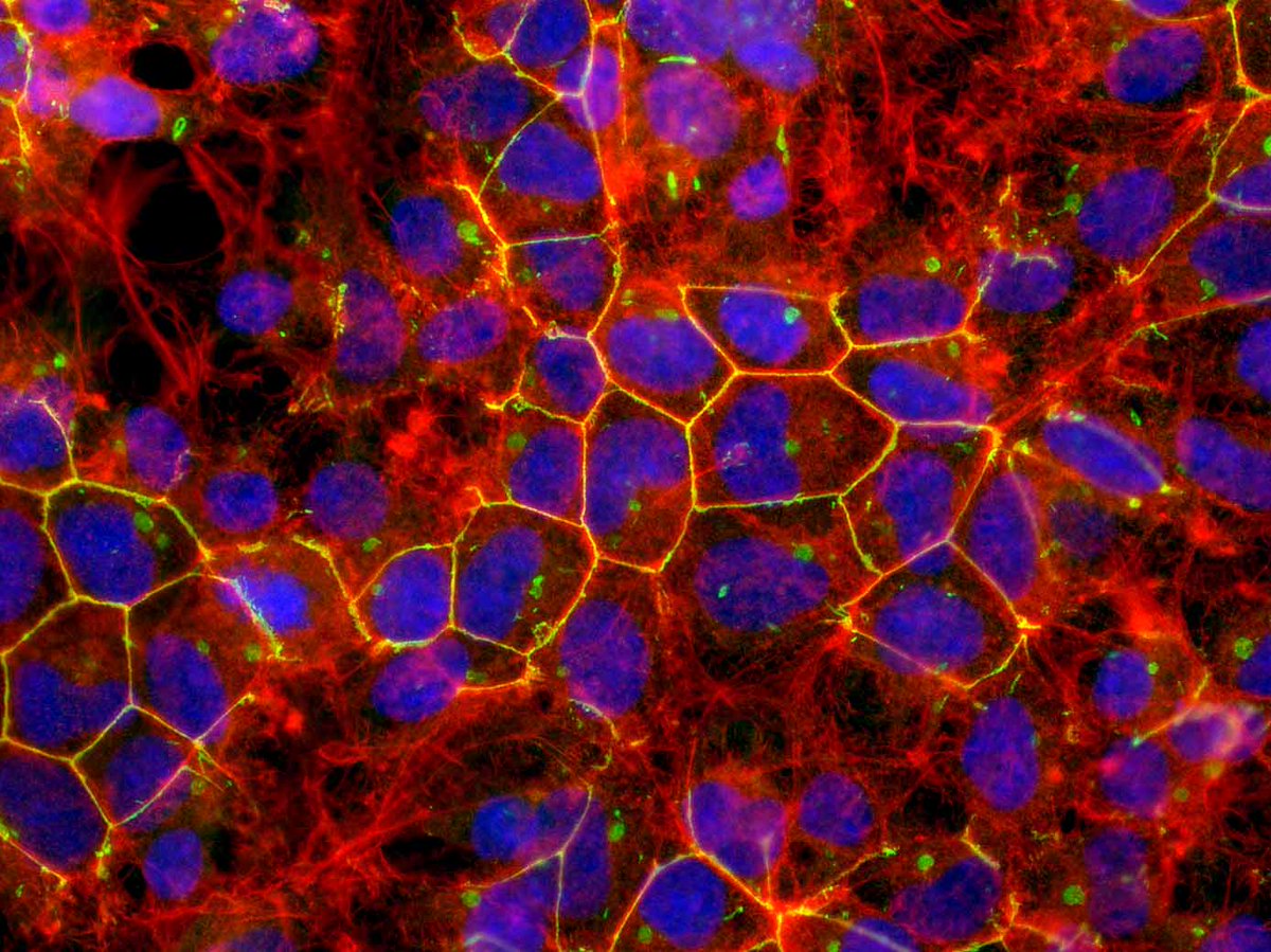 officialatcc's tweet photo. Advanced cell culture technologies like #organoids and conditional reprogramming of #cells can generate #cancer models that better recapitulate the complexity of human tumors. Explore these advanced cell models in our growing #HCMI collection. https://t.co/ykSYQ20hGG https://t.co/Z9UNXZQwGA