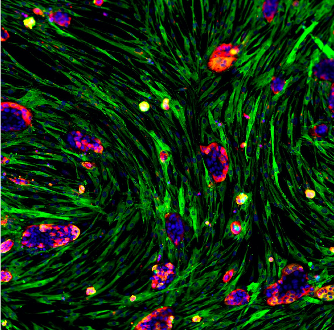 Pharma Technology Focus (@pharmatechfocus) on Twitter photo Targeting the tumour stroma: <a href="/PhenomicAI/">Phenomic AI</a> launches with $6m seed financing
#targetingthetumourstroma #treatingsolidtumours #seedfinancing
bit.ly/340yDy9 Targeting the tumour stroma: <a href="/PhenomicAI/">Phenomic AI</a> launches with $6m seed financing
#targetingthetumourstroma #treatingsolidtumours #seedfinancing
bit.ly/340yDy9